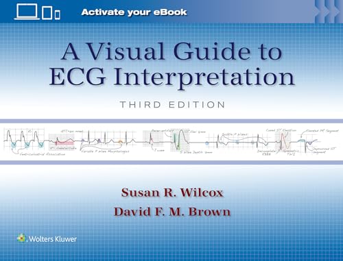 A Visual Guide to ECG Interpretation Print + eBook with Multimedia [Paperback]