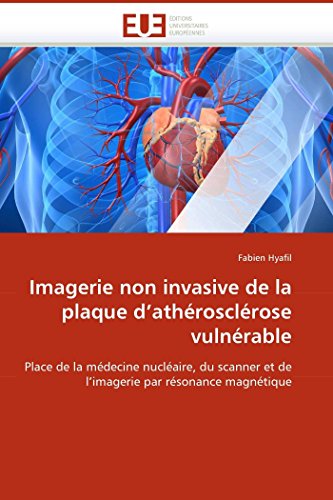 Imagerie Non Invasive De La Plaque D''athrosclrose Vulnrable Place De La Md [Paperback]