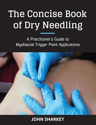 The Concise Book of Dry Needling A Practitioner's Guide to Myofascial Trigger P [Paperback]