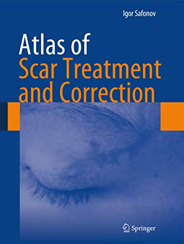 Atlas of Scar Treatment and Correction [Hardcover]
