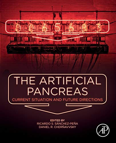 The Artificial Pancreas Current Situation and Future Directions [Paperback]