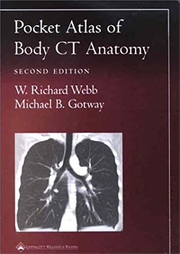 Pocket Atlas of Body CT Anatomy [Paperback]