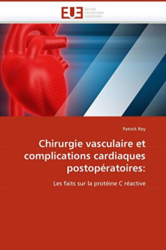 Chirurgie Vasculaire Et Complications Cardiaques Postopratoires Les Faits Sur [Paperback]