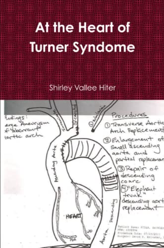 At The Heart Of Turner Syndrome [Paperback]