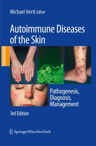 Autoimmune Diseases of the Skin Pathogenesis, Diagnosis, Management [Hardcover]