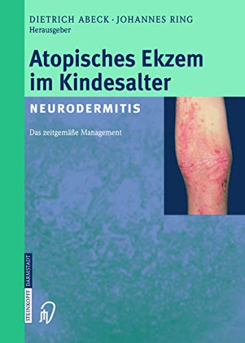 Atopisches Ekzem im Kindesalter (Neurodermitis) Zeitgemes Management [Paperback]