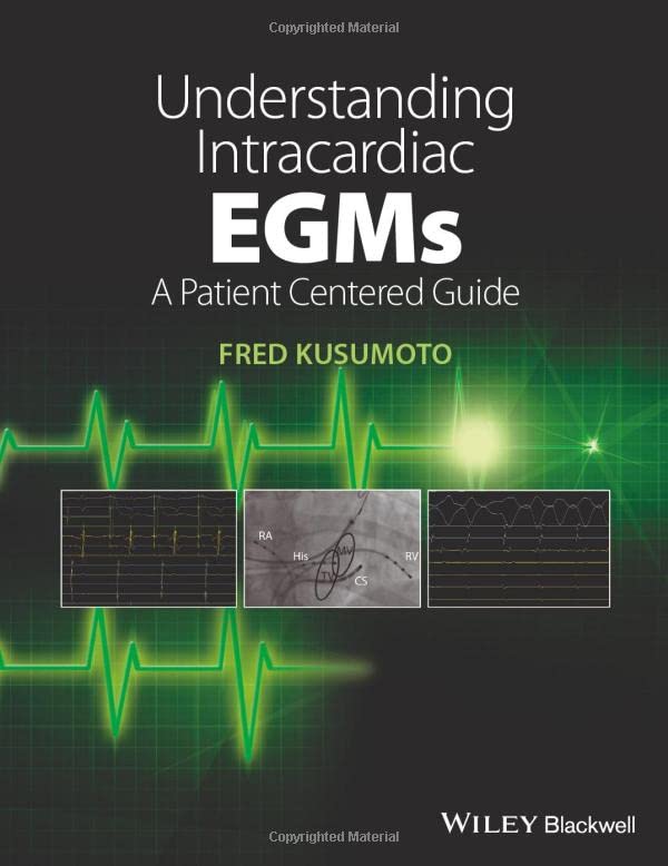 Understanding Intracardiac EGMs A Patient Centered Guide [Paperback]