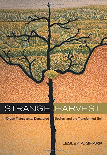 Strange Harvest Organ Transplants, Denatured Bodies, and the Transformed Self [Paperback]