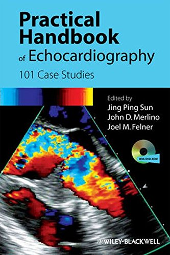Practical Handbook of Echocardiography 101 Case Studies [Paperback]