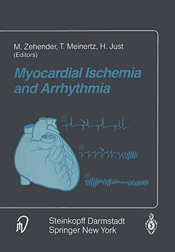 Myocardial Ischemia and Arrhythmia Under the auspices of the Society of Coopera [Paperback]