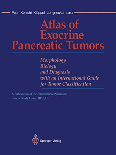 Atlas of Exocrine Pancreatic Tumors Morphology, Biology, and Diagnosis with an  [Paperback]