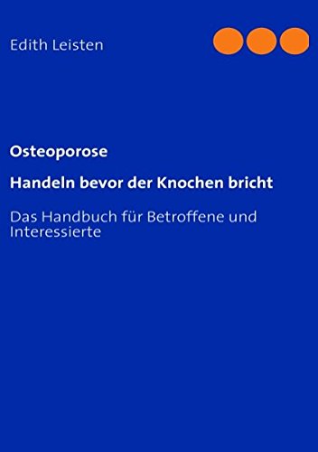 Osteoporose  Handeln bevor der Knochen bricht [Paperback]