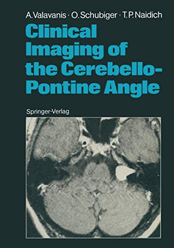 Clinical Imaging of the Cerebello-Pontine Angle [Paperback]