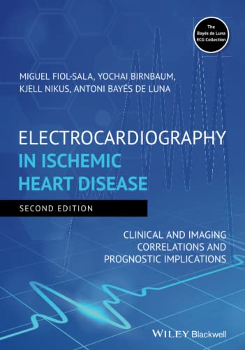 Electrocardiography in Ischemic Heart Disease Clinical and Imaging Correlations [Hardcover]