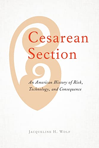 Cesarean Section An American History of Risk, Technology, and Consequence [Paperback]