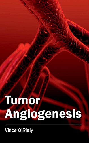 Tumor Angiogenesis [Hardcover]
