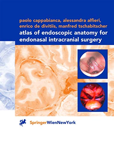 Atlas of Endoscopic Anatomy for Endonasal Intracranial Surgery [Paperback]