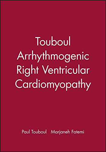 Touboul Arrhythmogenic Right Ventricular Cardiomyopathy [Paperback]