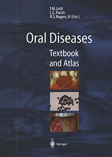 Oral Diseases Textbook and Atlas [Paperback]