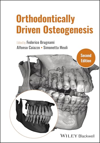 Orthodontically Driven Osteogenesis [Hardcover]