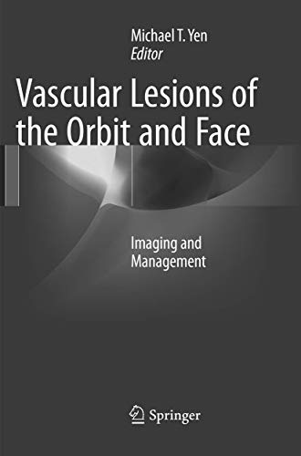 Vascular Lesions of the Orbit and Face Imaging and Management [Paperback]