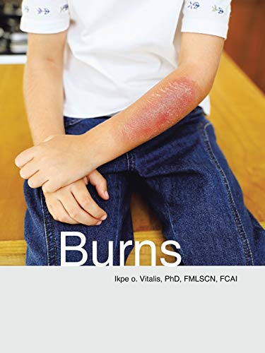 Burns [Paperback]