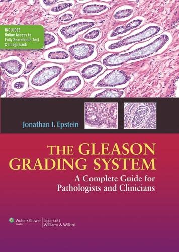 The Gleason Grading System A Complete Guide for Pathologist and Clinicians [Hardcover]