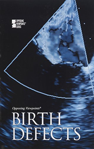 Birth Defects (opposing Viewpoints) [Paperback]