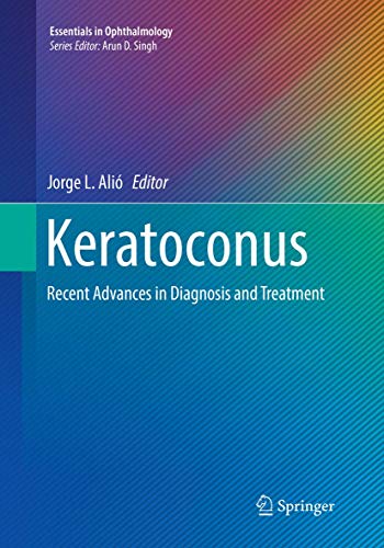 Keratoconus Recent Advances in Diagnosis and Treatment [Paperback]