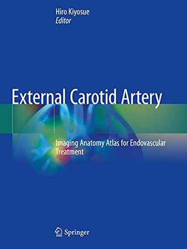 External Carotid Artery Imaging Anatomy Atlas for Endovascular Treatment [Paperback]