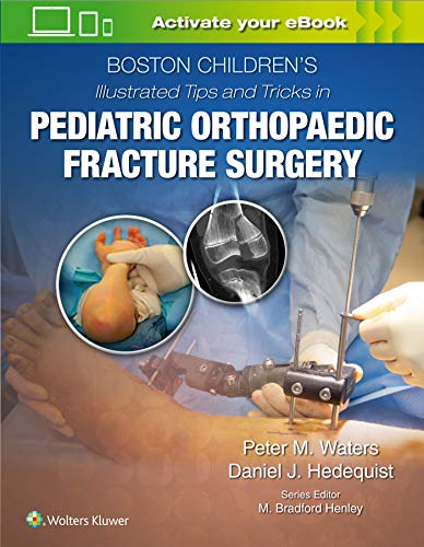 Boston Childrens Illustrated Tips and Tricks  in Pediatric Orthopaedic Fracture [Hardcover]
