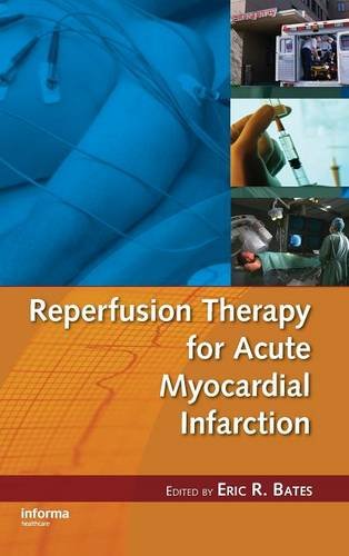 Reperfusion Therapy for Acute Myocardial Infarction [Hardcover]