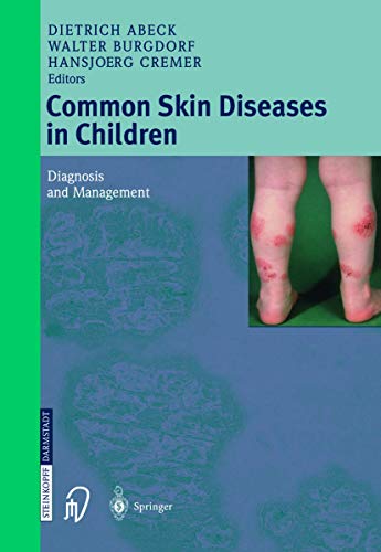 Common Skin Diseases in Children Diagnosis and Management [Paperback]