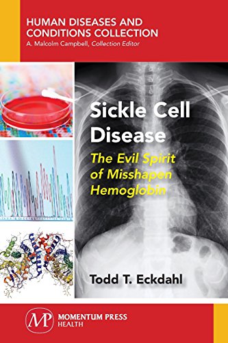 Sickle Cell Disease The Evil Spirit Of Misshapen Hemoglobin [Paperback]