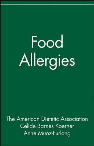 Food Allergies The Nutrition Now Series [Paperback]