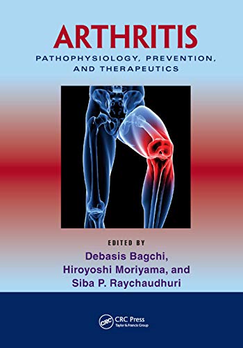 Arthritis Pathophysiology, Prevention, and Therapeutics [Paperback]