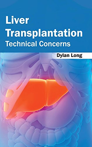 Liver Transplantation Technical Concerns [Hardcover]