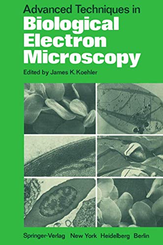 Advanced Techniques in Biological Electron Microscopy [Paperback]