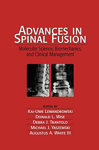 Advances in Spinal Fusion Molecular Science, BioMechanics, and Clinical Managem [Hardcover]