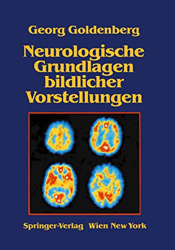 Neurologische Grundlagen bildlicher Vorstellungen [Paperback]