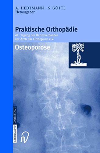 Osteoporose [Paperback]