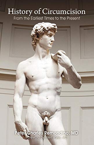 History Of Circumcision From The Earliest Times To The Present [Paperback]