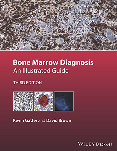 Bone Marrow Diagnosis An Illustrated Guide [Hardcover]