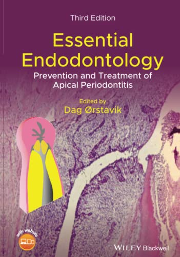 Essential Endodontology Prevention and Treatment of Apical Periodontitis [Hardcover]