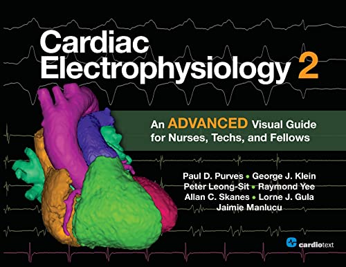 Cardiac Electrophysiology 2 An Advanced Visual Guide for Nurses, Techs, and Fel [Paperback]