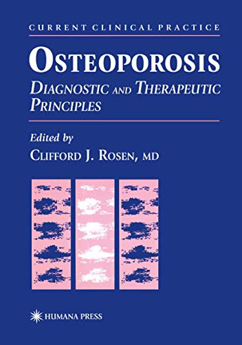 Osteoporosis Diagnostic and Therapeutic Principles [Hardcover]