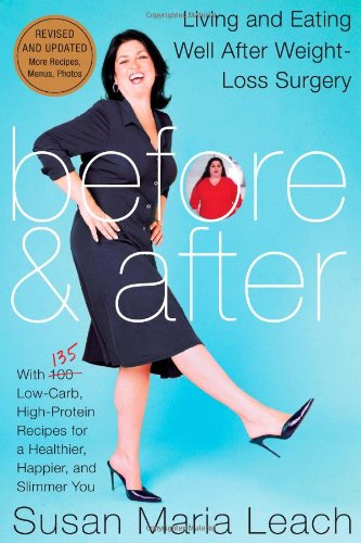 Before and After Living and Eating Well after Weight-Loss Surgery [Paperback]