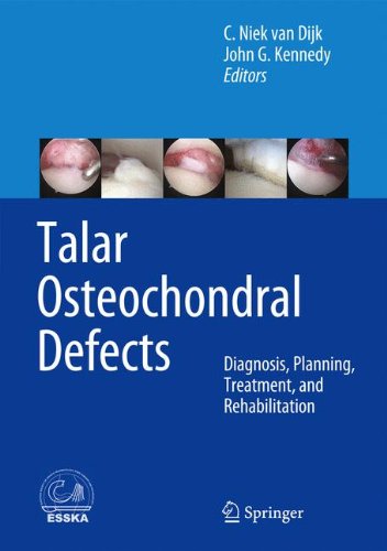 Talar Osteochondral Defects Diagnosis, Planning, Treatment, and Rehabilitation [Hardcover]