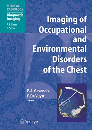 Imaging of Occupational and Environmental Disorders of the Chest [Hardcover]