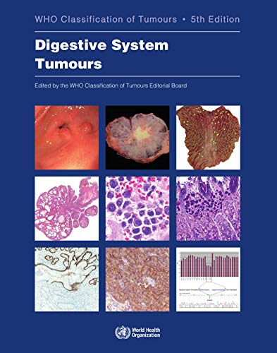 Digestive System Tumour [Paperback]